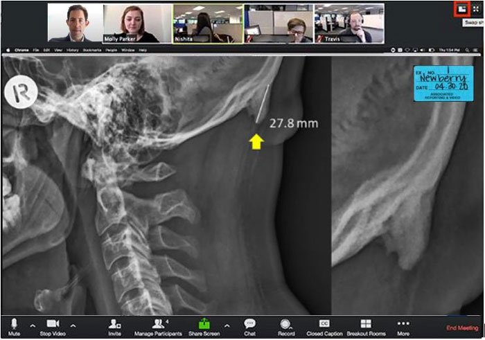 Zoom-Recording-of-Deposition
